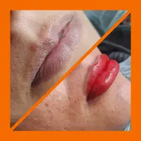 خدمات دائم تتوصورت و بدن