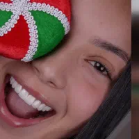 کامپوزیت ونیر هر فک ۱۲ میلیون تومان