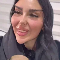 افزایش آلت تناسلی.لیفت بانخ.ژل بوتاکس.پاک کردن تتو|خدمات زیبایی و سلامت|قم, بکایی|دیوار