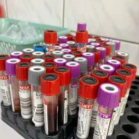 نمونه گیر و پذیرش آزمایشگاه همراه با استخدام