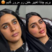 ژل و فیلر صورت و بدن|خدمات آرایشگری و زیبایی|اصفهان, ملک|دیوار