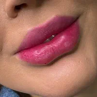 جشنواره تزریق فیلرلب روسی/فول فیس عربی|خدمات آرایشگری و زیبایی|تهران, فلاح|دیوار