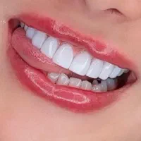 فرصتی ویژه برای انجام کامپوزیت زیبایی