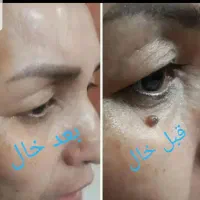 پاک کردن تاتوهای قدیمی وجدید مثل حیوانات ونوشتاری|خدمات آرایشگری و زیبایی|قم, بلوار امین و ساحلی|دیوار