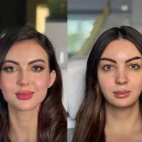 تخفیفات یلدایی ،مدل رایگان ،کلینیک دارای ۳شعبه|خدمات آرایشگری و زیبایی|شهریار, شهرک بهاران (ویره)|دیوار