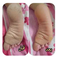 کفسابی و اسپا در منزل فقط با یک جلسه نیم ساعته
