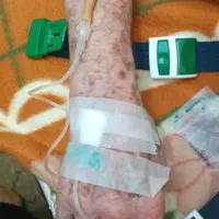 تزریقات در منزل،وصل سرم در منزل همرا سرم و آمپول