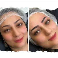 میکروبلیدینگ/فیبروز/بنمژه/خط چشم/شیدینگ