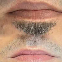 رفع تیرگی و شیدینگ لب آقایان با تخفیف ویژه جشنواره
