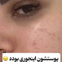 پووست موو|آرایشی، بهداشتی، درمانی|چیتاب, |دیوار