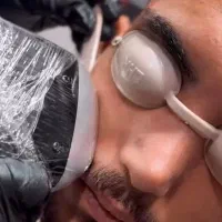 خدمات فیشال و لیزر تخفیف بلک فرایدی|خدمات آرایشگری و زیبایی|قائمشهر, |دیوار