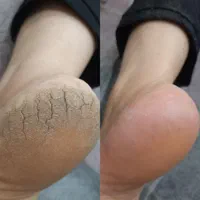 پدیکور درمانی|خدمات آرایشگری و زیبایی|اسدآباد, |دیوار