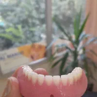 دندانسازی ، دندان مصنوعی|پزشکی|اصفهان, شاهد|دیوار