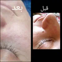 پاکسازی صورت