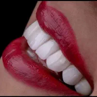 زیبایی لبخند با نازلترین قیمت و شرایط اقساطی