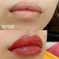 شیدلب.رفع تیرگی.فشیال تخصصی.آموزش.پیراپزشک هستم|خدمات آرایشگری و زیبایی|زاهدان, |دیوار
