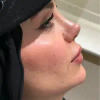 جراحی زیبایی بینی فقط با۳۰میلیون کلینیک تخصصی