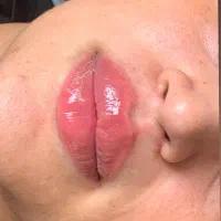 تزریق ژل سی سی ۴۰۰|خدمات آرایشگری و زیبایی|رباط‌کریم, نصیرشهر|دیوار