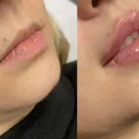 کلینیک تخصصی زیبایی/بوتاکس فیلر لاغری مزو PRP|خدمات آرایشگری و زیبایی|رفسنجان, |دیوار