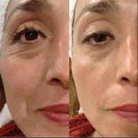 کلیه خدمات زیبایی بوتاکس وفیلر