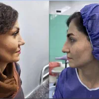 عمل جراحی بینی توسط فوق تخصص گوش و حلق و بینی