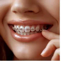 ارتودنسی اقساطی با تعرفه دولتی