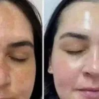 لکه صورت . تنگ ی . و ا ژ ن . سوال آئین  نامه