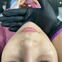 تزریق ژل. بوتاکس|خدمات آرایشگری و زیبایی|کرج, حصارک پایین|دیوار