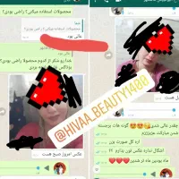 کرم بوتاکس و چاقی صورت لارا