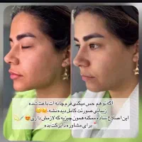 خدمات ژل و بوتاکس|خدمات آرایشگری و زیبایی|مشهد, سجاد شهر|دیوار