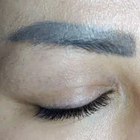 کاشت مو .و.ابرو.خرمدره