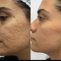 مرکزلیزروجوانسازی پوست