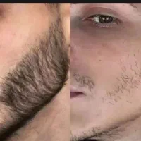 این اخرین روشیه که امتحان میکنی
