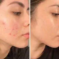 پوستتو شفاف و زیبا کن