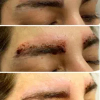 ریمو تخصصی ابرو با قیمت ویژه|خدمات زیبایی و سلامت|کرمانشاه, |دیوار