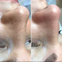 پاکسازی و جوانسازی پوست (فیشیال)|خدمات آرایشگری و زیبایی|تهران, مدائن|دیوار