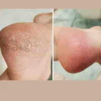 پدیکور پا