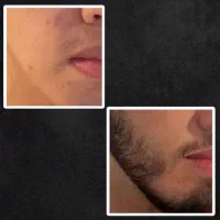 چالشی با ریشات