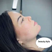 تزریق ژل و بوتاکس و مزو ( جوانسازی و روشن کننده)|خدمات آرایشگری و زیبایی|اهواز, گلستان|دیوار