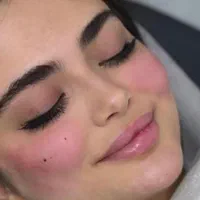 ژل هر ccفقط ۳۵۰