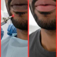 تنها راه درمان و رفع تیرگی لب آقایان|خدمات آرایشگری و زیبایی|مرودشت, بیست متری بیمارستان|دیوار