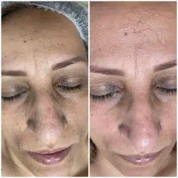 پاکسازی،کربوکسی با تخفیف50 ٪ برای اقایان بانوان|خدمات آرایشگری و زیبایی|بیرجند, |دیوار