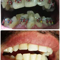 ارتودنسی ارزانتر از تعرفه نظام پزشکی،ایمپلنت فوری|خدمات آرایشگری و زیبایی|تهران, آذربایجان|دیوار