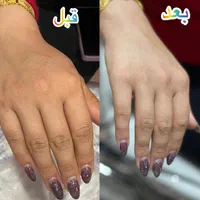 پارافین تراپی/رفع خشکی و تیرگی/لایه های شاخی/پوست|خدمات آرایشگری و زیبایی|شیراز, نصر|دیوار