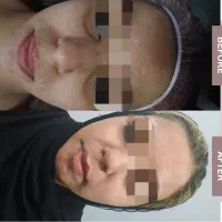 آف 30% فیشیال تخصصی  + مشاوره ی رایگان|خدمات آرایشگری و زیبایی|اهواز, نادری|دیوار