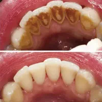 جرم گیری رایگان|خدمات آرایشگری و زیبایی|بیرجند, |دیوار