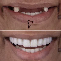 وام دندانپزشکی دکتر اسلامی فر|خدمات آرایشگری و زیبایی|ساوه, |دیوار