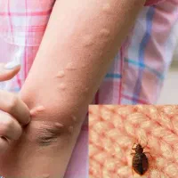سم پاشی سوسک وموریانه زدایی|خدمات نظافت|هندیجان, |دیوار