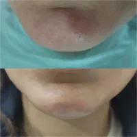 فیشیال|خدمات آرایشگری و زیبایی|رفسنجان, |دیوار