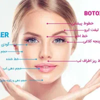 تزریق ژل فیلر بوتاکس مزوتراپی مو ابرو صورت پی آرپی|خدمات آرایشگری و زیبایی|اهواز, نادری|دیوار
